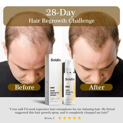 Exclusive Hair Growth Set Snidin Hair Growth Spray + UFNA Batana Oil