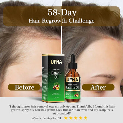 Exclusive Hair Growth Set Snidin Hair Growth Spray + UFNA Batana Oil
